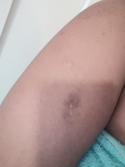 My daughter hurts me :(