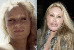 To think that a lot of genuinely beautiful people ruin themselves with plastic surgery etc?