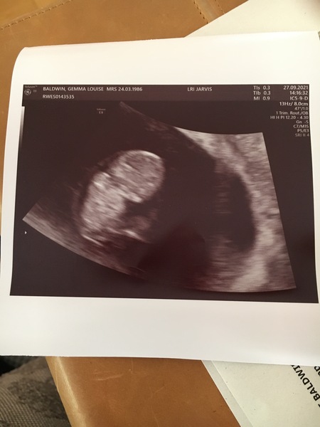 Due May 2022 Thread 2