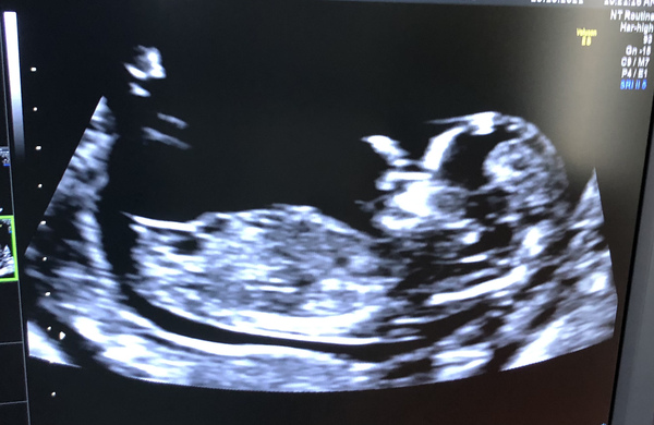 Due May 2022 Thread 2