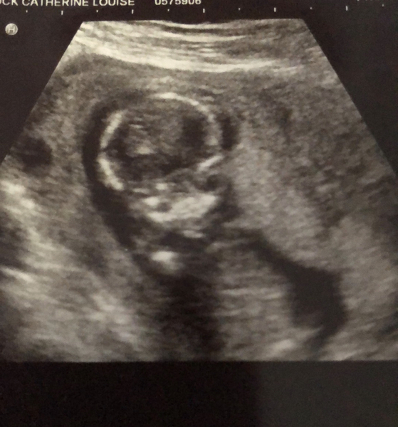 Pregnant at 35+ (old ovaries, new lines) - Thread 2