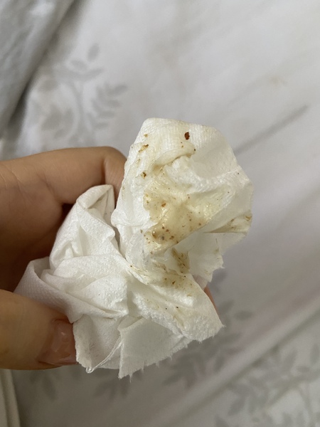 Discharge after colposcopy??