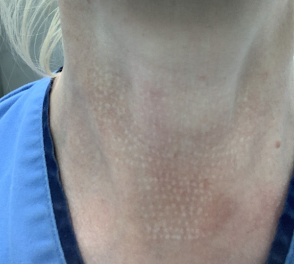HELP ME CHANGE THE LAW ! -when beauty therapy leaves you scarred