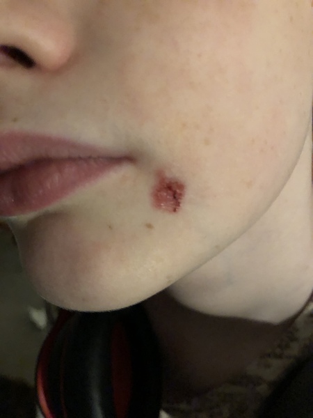 What the heck is on my child’s  face ?!