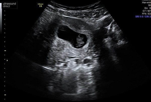 Due May 2022 Thread 2