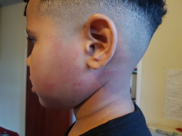 Dad slapped son during visitation