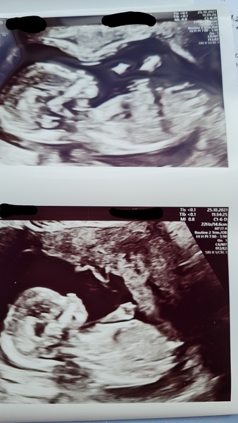 Guess the gender..