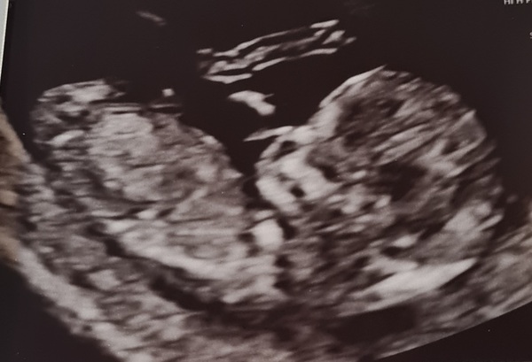 Guess the sex?