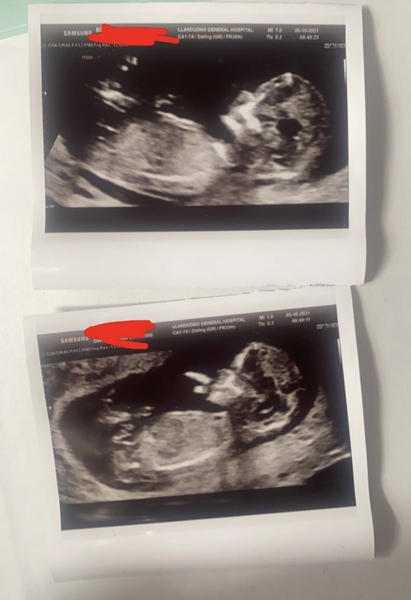 Any Guesses, Boy or Girl?