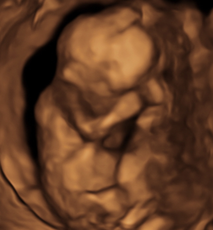 Pregnant at 35+ (old ovaries, new lines) - Thread 2