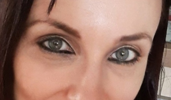 Treatment for undereye pigmentation