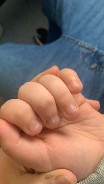 Nail chewing advice