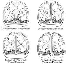 I have just found out I am having Twins after 3yrs ttc