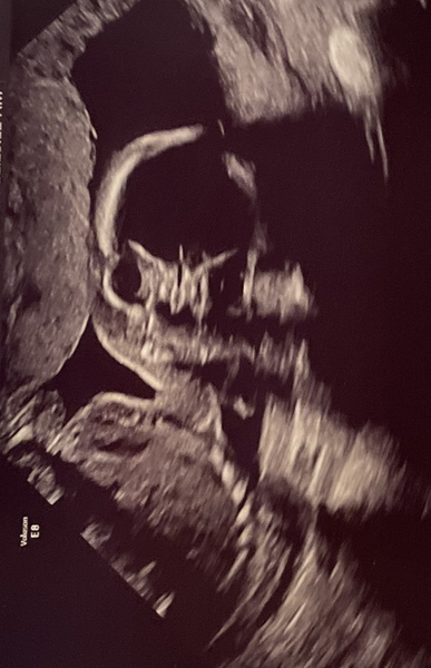 Due February 2022 (thread 3)