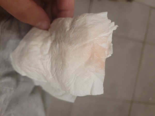 Implantation bleed or Chemical? Advice please