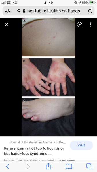 Weird rash, internet detectives assemble!