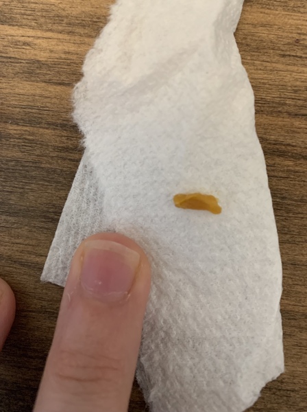 Just got this out of baby’s ear