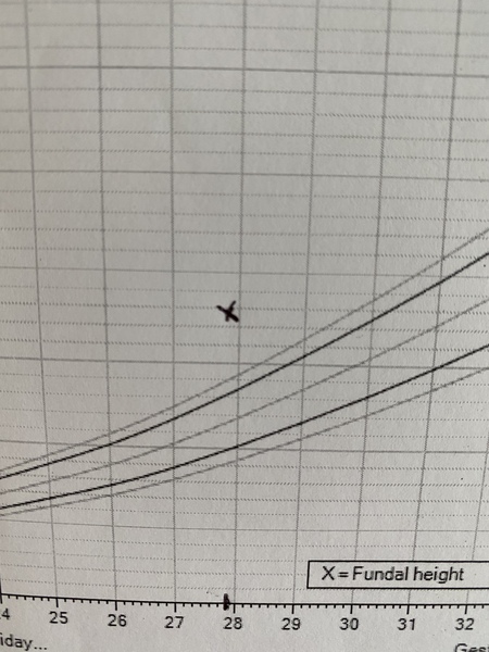Monster fundal height at 28w