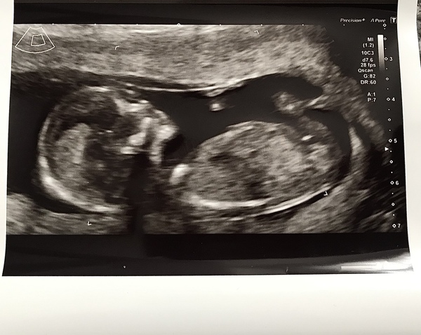 April 2022 Birth Club