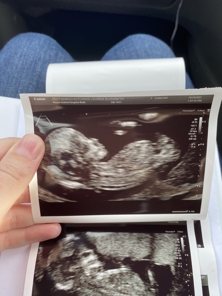 🤰🏼April 2022 Birth thread 🤰🏼