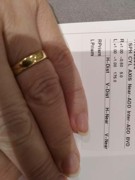 Anyone else's DC had a very sudden deterioration in eyesight?