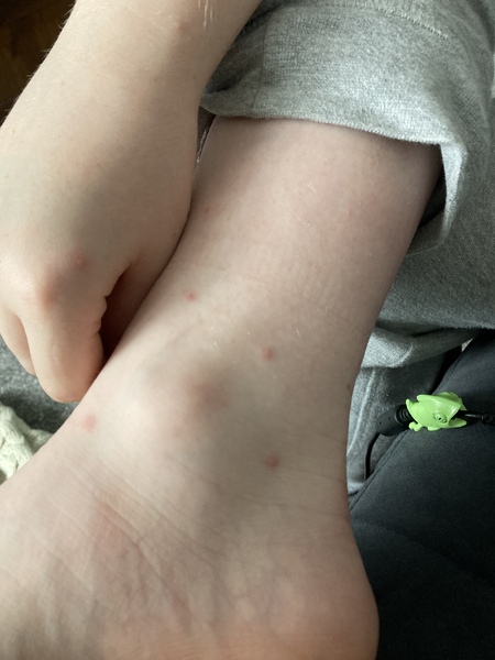 Does this look like fleas?