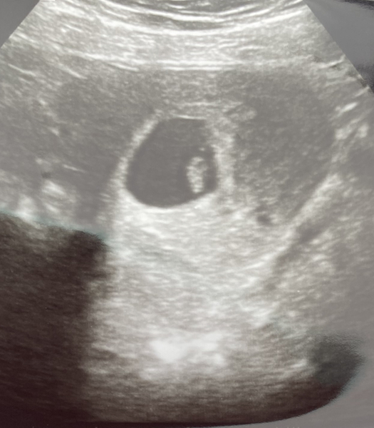 Due June 2022 (thread two)