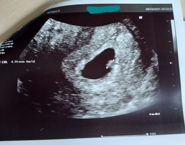 This has to be a new pregnancy, right?