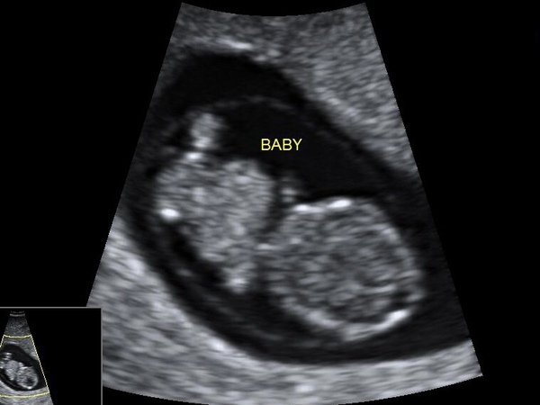 Due May 2022 Thread 2