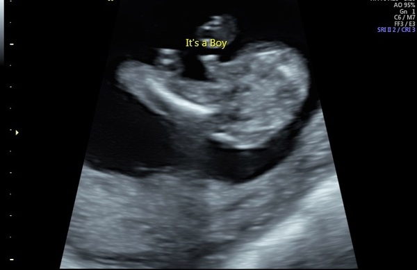 Do you agree with the scan- boy?