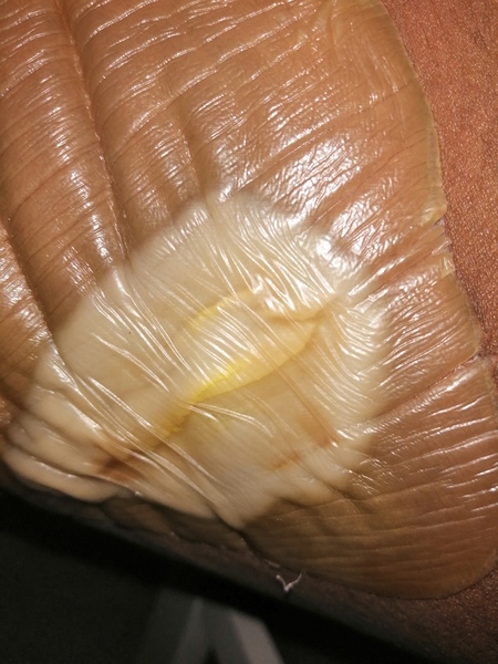 I'm in utter agony.. Please help me identify what this is..