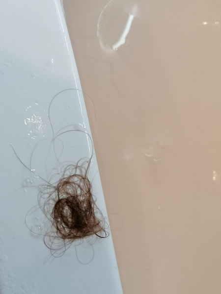 Warning-grossness.. Is this much hairloss normal?