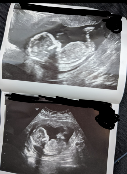 Just for fun! Boy or girl?