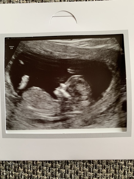 Tracking your cycle and possible BFP using RHR - part 6