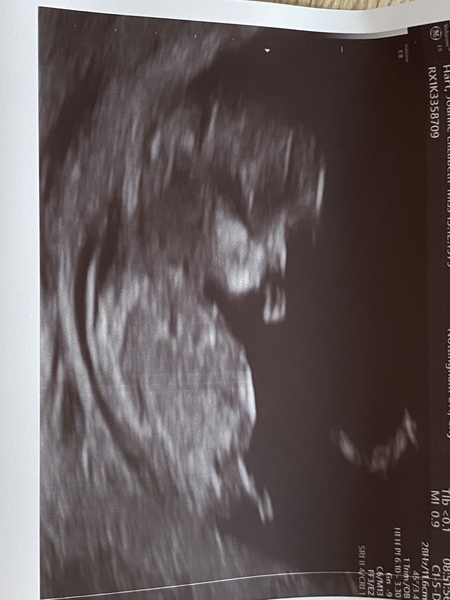 Due May 2022 Thread 2