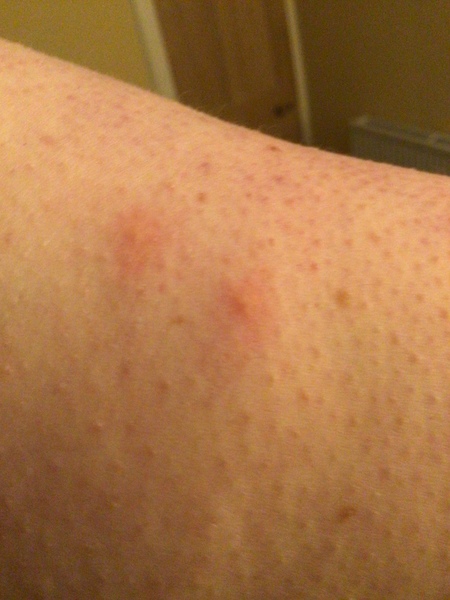 Come identify my spots