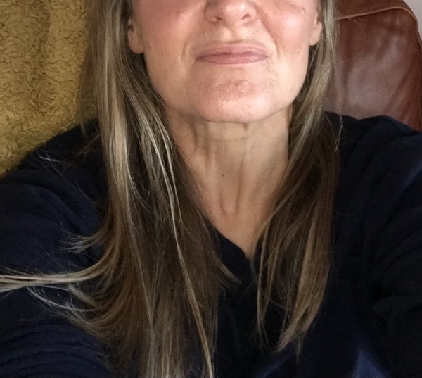 That loose middle neck skin - does anything help?