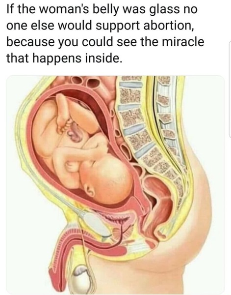 The Scientist erases pregnant women: Male placentas produce more proinflammatory molecules than female placentas, while pregnant people carrying male fetuses produce fewer antibodies in response..