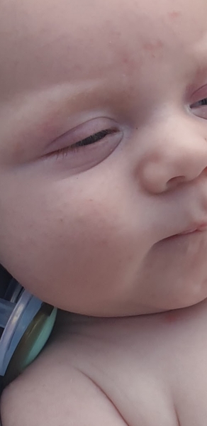 Moving lump in babies cheek