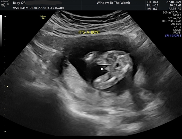 April 2022 Birth Club