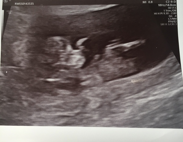 Due May 2022 Thread 2