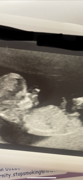 Any guesses on boy or girl!?