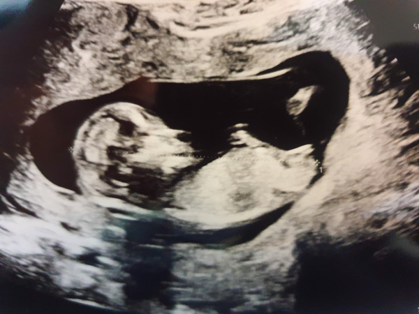 Due May 2022 Thread 2