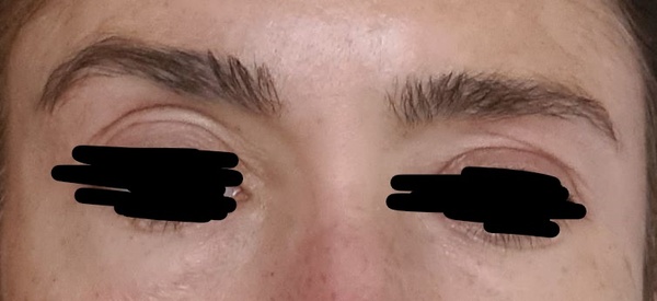 I feel so ugly - my eyes/ eyebrows asymmetrical