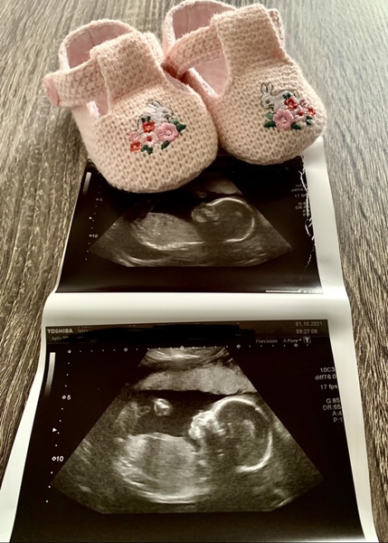Due February 2022 (thread 3)