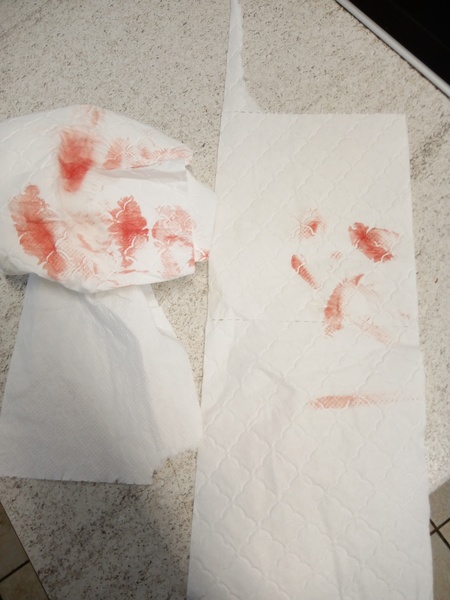 6dpo and already had symptoms