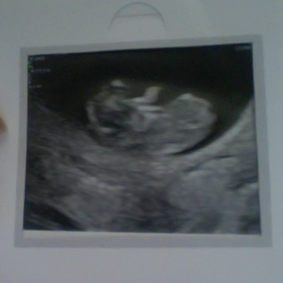 Due May 2022 Thread 2