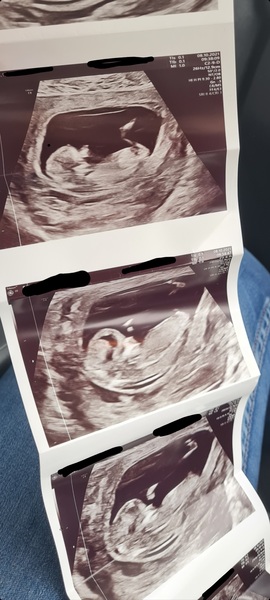 Guess the gender..