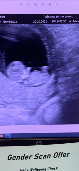 Anyone else 5 weeks pregnant?