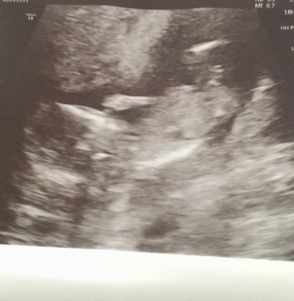 Due May 2022 Thread 2